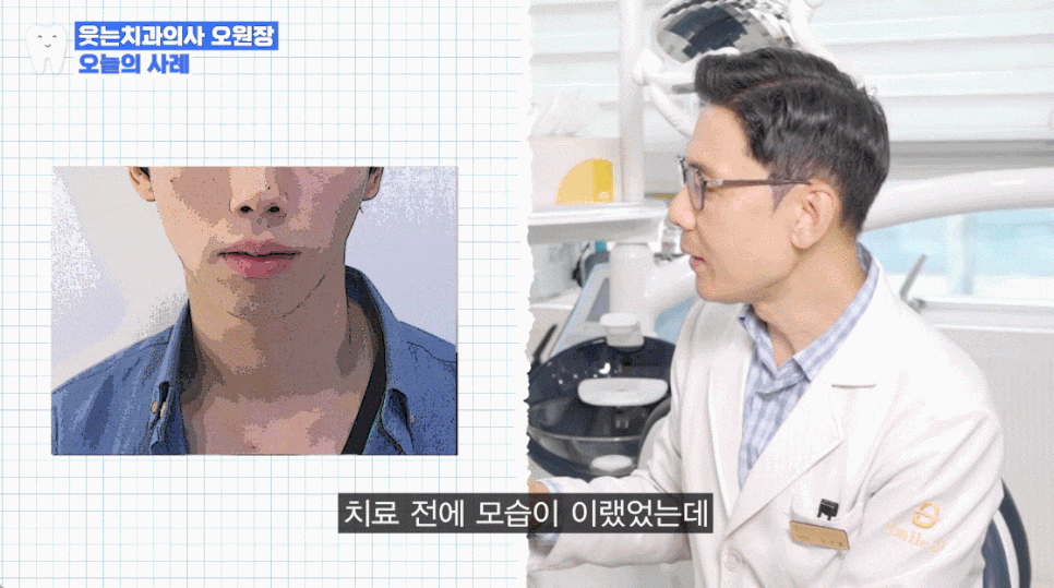 돌출입교정치과 수술 없이 무턱교정으로도 개선 가능합니다 관련 이미지 18