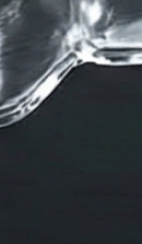 신사역치과 치아교정 전 꼭 확인해야 할 정밀 진단 기준 관련 이미지 38