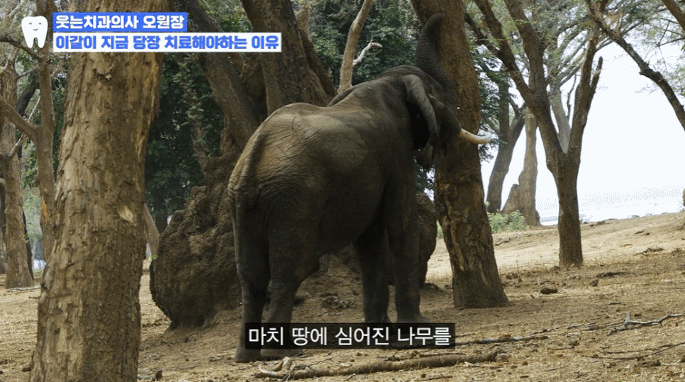 이갈이 이유, 단순한 습관이 아니라 부정교합 때문? 관련 이미지 4