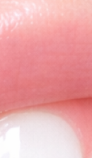 What to Check Before Choosing a Gangnam Laminate Dental Clinic image 32