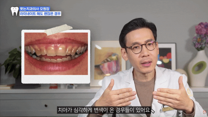 Sinsa Station No-Prep Veneers: How Are Veneers Different from Crowns? image 2