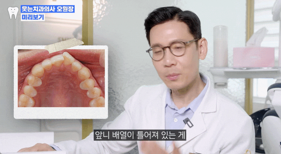 Rabbit Teeth Correction? A Complete Guide to Treatment Period, Cost, and Reviews for Partial Correction of Rabbit-Like Front Teeth image 1