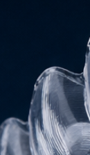 강남교정치과 결정 전 고려할 사항은 관련 이미지 33