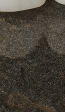 Systematic Examination Process to Review Before Deciding on Front Teeth Laminates image 48