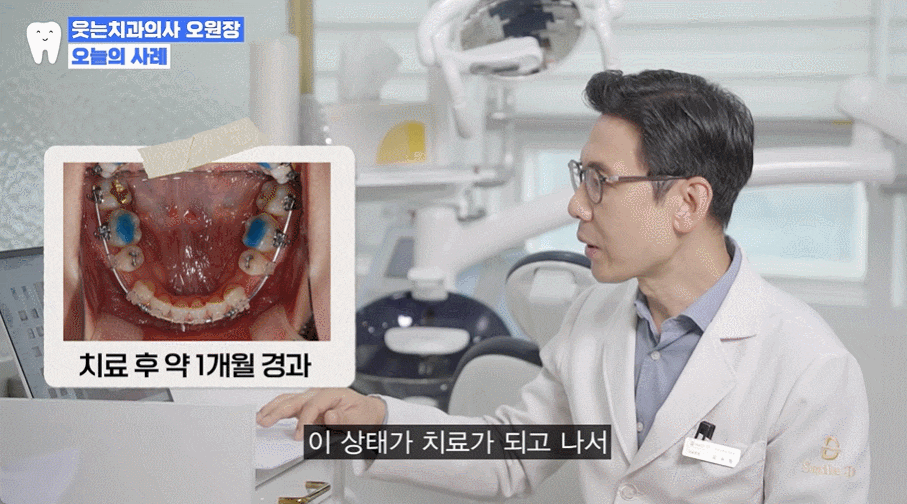주걱턱 치아교정? 효과적인 주걱턱 교정 시기는 언제 관련 이미지 9