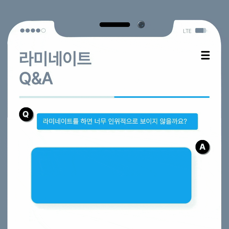 What to Check When Considering No-Prep Laminate Veneers in Gangnam image 16