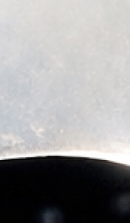 논현역 라미네이트 치과 후회 없는 선택을 위해 체크할 요소들 관련 이미지 30