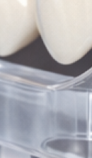 40대 치아 교정 고민 중이라면? 부담 줄이고 효율 높이는 선택법 관련 이미지 28