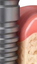 If You’re Considering a Seoul Implant Dental Clinic image 39