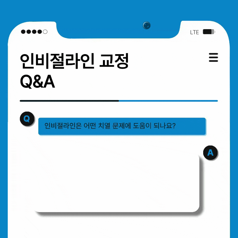 성인 돌출입 교정, 발치 없이도 변화가 가능할까? 관련 이미지 7