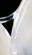 서울교정치과 선택 전 확인해야 할 정밀 진단 기준 관련 이미지 27