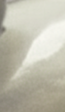 강남무삭제라미네이트치과 선택을 위한 정밀 정보 관련 이미지 30