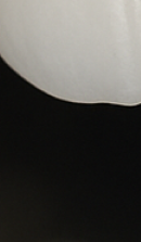 앞니 벌어짐 치료 전 반드시 체크해야 할 것들 정리 관련 이미지 36