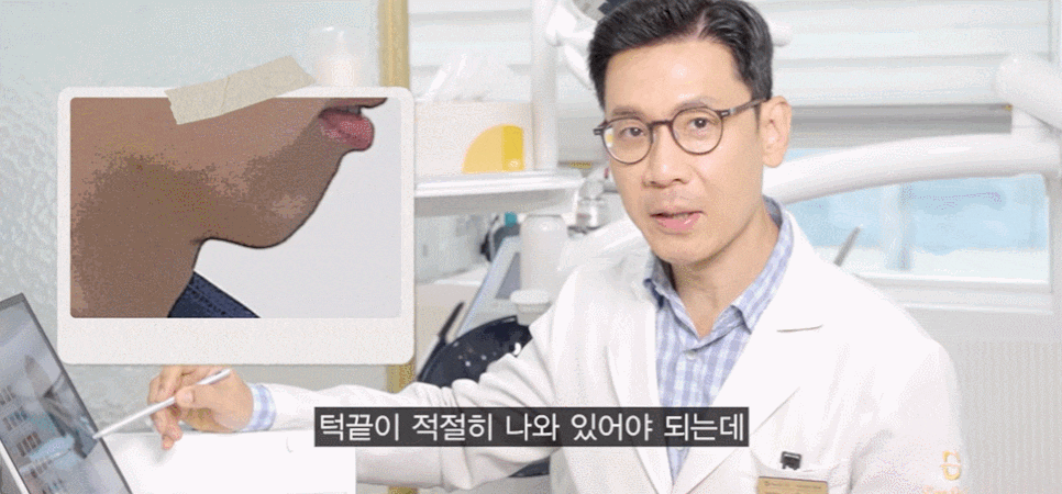 무턱교정전후, 얼굴 라인 어떻게 달라지는지 <공개> 관련 이미지 2