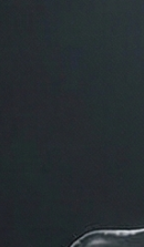 신사역치과 치아교정 전 꼭 확인해야 할 정밀 진단 기준 관련 이미지 27