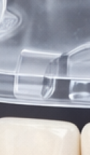 40대 치아 교정 고민 중이라면? 부담 줄이고 효율 높이는 선택법 관련 이미지 37