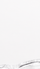 A Summary of How to Use Clear Aligners and Step-by-Step Guidelines image 37