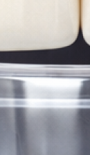 40대 치아 교정 고민 중이라면? 부담 줄이고 효율 높이는 선택법 관련 이미지 31