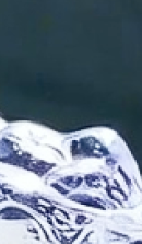 강남 임플란트 치과 초기 단계의 정밀한 분석이 중요한 이유 관련 이미지 32