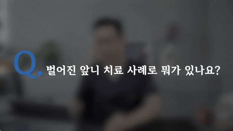 벌어진 앞니 레진 vs 교정? 딱 3분만 투자해서 10년 후회 막는 법 관련 이미지 2