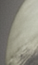 강남무삭제라미네이트치과 선택을 위한 정밀 정보 관련 이미지 36