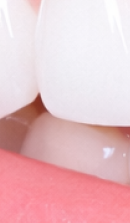 What to Check Before Choosing a Gangnam Laminate Dental Clinic image 38