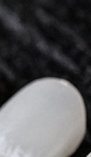 Curious About the Minimal-Preparation Laminate Procedure? image 40