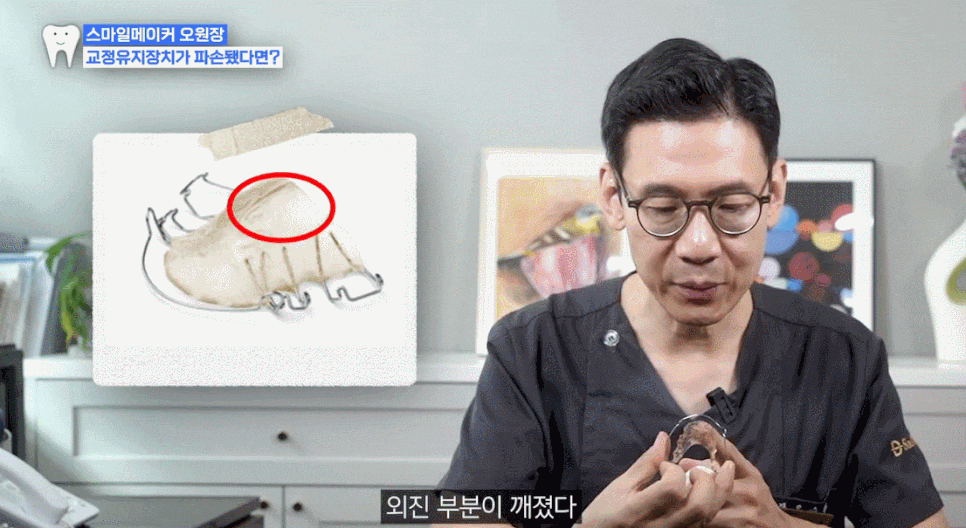 Orthodontic Retainer Period: A Clear Guide image 7