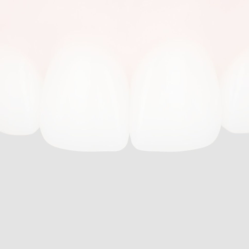 어린이 부정교합, 무턱 교정은 &lsquo;성장기 타이밍&rsquo;이 중요해요 관련 이미지 36