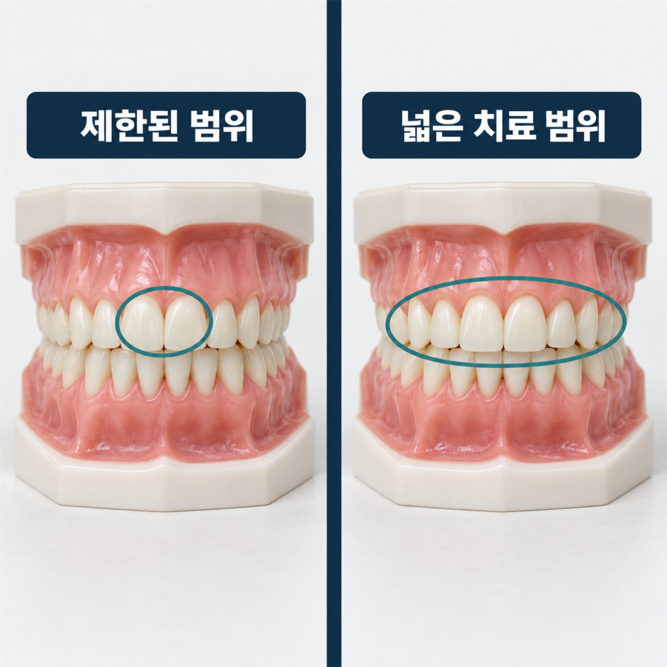 재교정 기간, 다시 시작하면 처음처럼 오래 걸릴까요? 관련 이미지 6