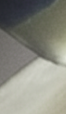 강남무삭제라미네이트치과 선택을 위한 정밀 정보 관련 이미지 28