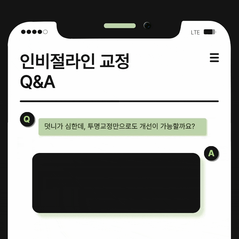 돌출입 교정 기간 줄일 수 있을까? 기간 단축을 돕는 핵심 요소 관련 이미지 19