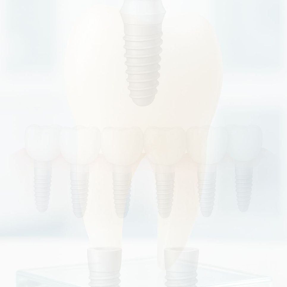 무삭제 라미네이트 후기 꼼꼼히 찾아봤어요 관련 이미지 14