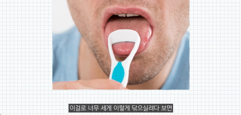 Types and Causes of Bad Breath, and How to Resolve It <Must-Read If Your Breath Smells Terrible> image 4