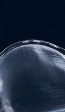 강남교정치과 결정 전 고려할 사항은 관련 이미지 30