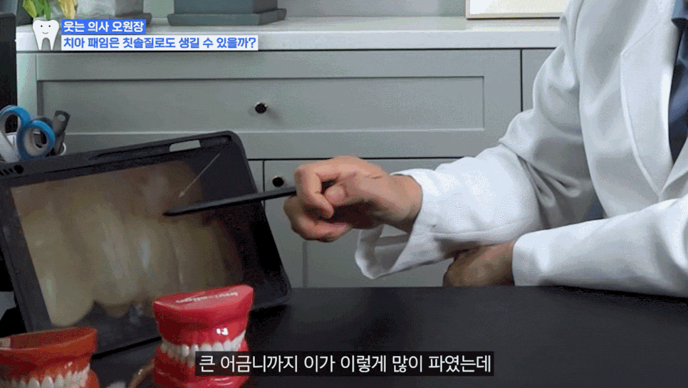 Gum Recession, Tooth Notching: Causes and Solutions <Must Read in 1 Minute> image 6