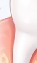 강남 교정치과 과정과 필수 분석 사항들 관련 이미지 37