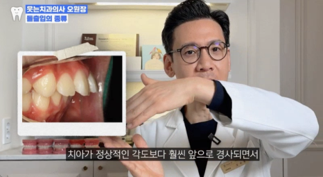 Protruding Mouth Correction Is Also Possible with Invisalign <Written by a Specialist with 18 Years of Experience> image 8