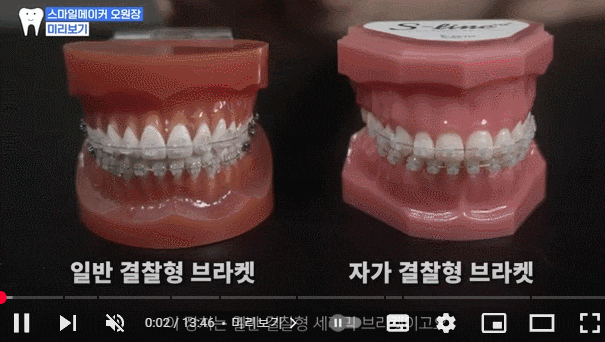 서울 교정치과추천 체크리스트 알려드립니다. 관련 이미지 8