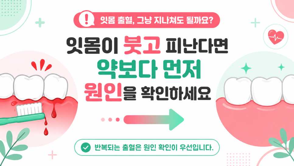 잇몸 염증, 붓고 피날 때 약보다 먼저 확인할 것은? 관련 이미지 2