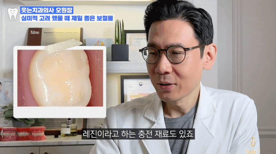 Laminates Cost, How to Restore Discolored Dental Resin to White image 5