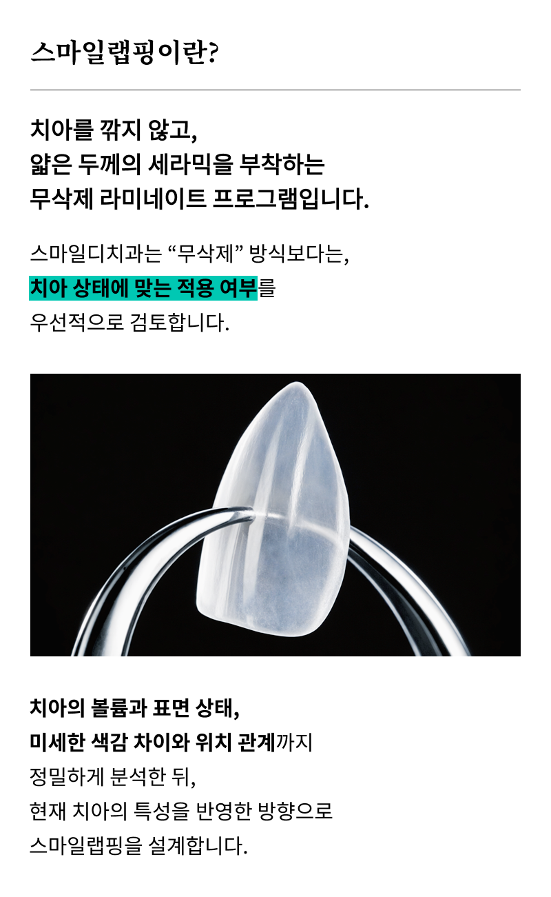 강남무삭제라미네이트치과 선택을 위한 정밀 정보 관련 이미지 9