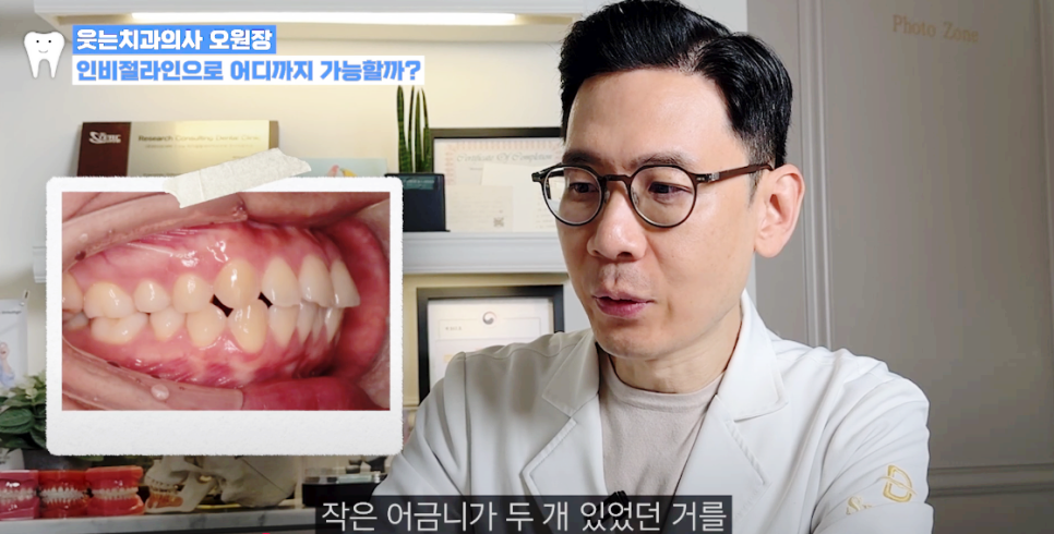 인비절라인 발치 여부에 대한 오해와 진실 알아보기 관련 이미지 12