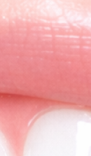 What to Check Before Choosing a Gangnam Laminate Dental Clinic image 30