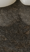 Systematic Examination Process to Review Before Deciding on Front Teeth Laminates image 47