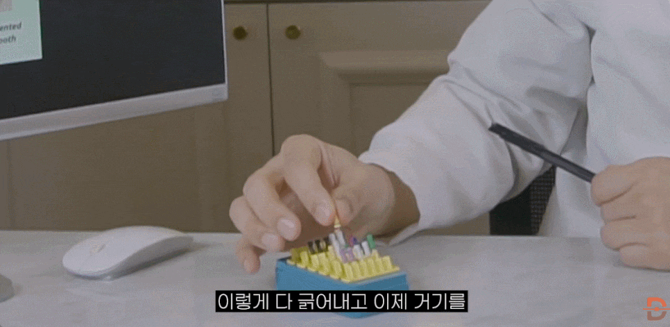 크라운 치료 가격 신경치료 후 크라운 꼭 해야 할까요? 관련 이미지 13