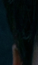 논현역교정치과 선택 전 반드시 확인해야 할 체크 포인트 관련 이미지 27