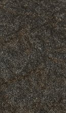 Systematic Examination Process to Review Before Deciding on Front Teeth Laminates image 26