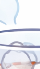 앞니 라미네이트 시술이 고민된다면 관련 이미지 37