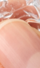 서울인비절라인치과 찾고 있다면 관련 이미지 24